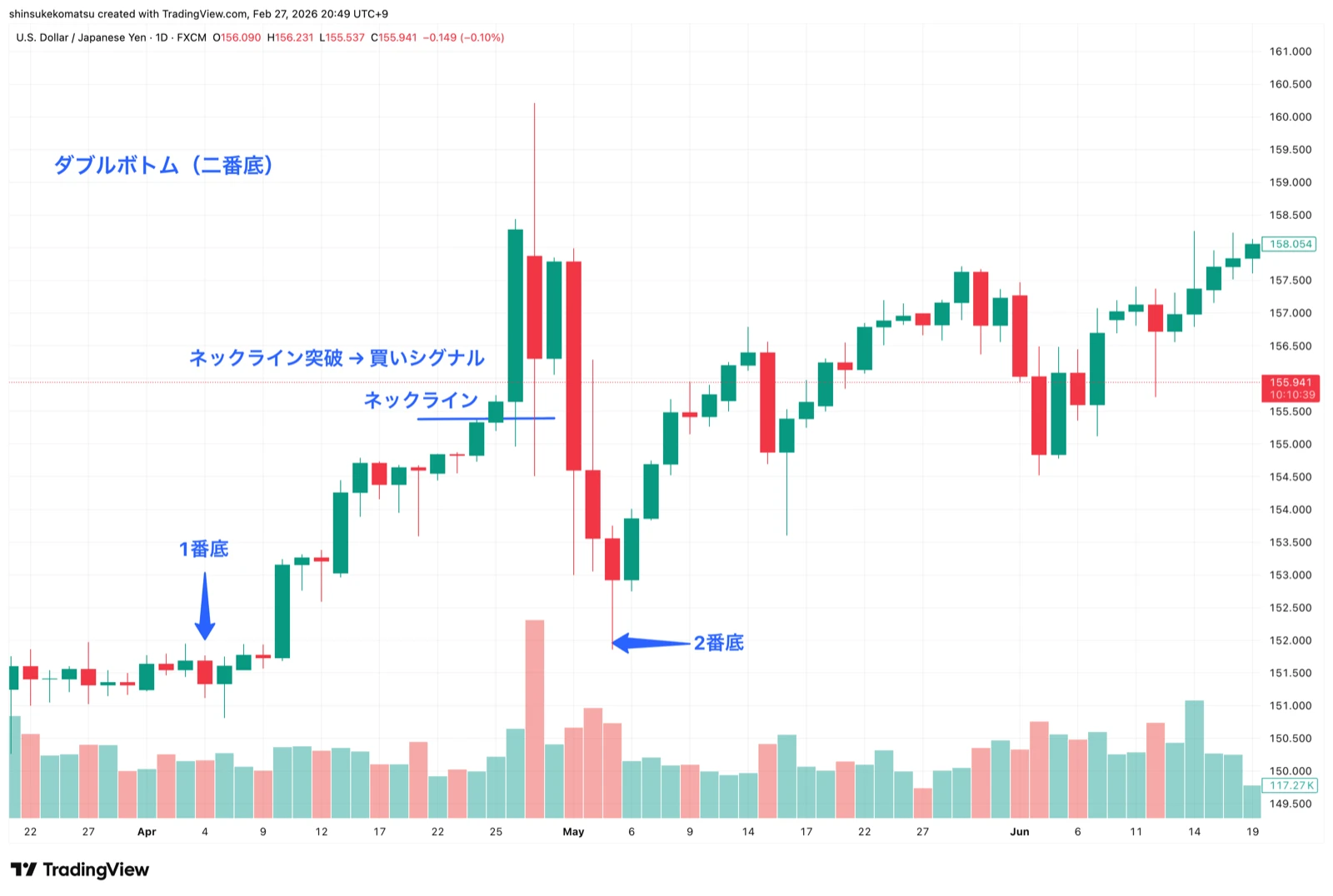ダイヤモンドボトムからの上方ブレイクアウト(EUR/USD 日足)
