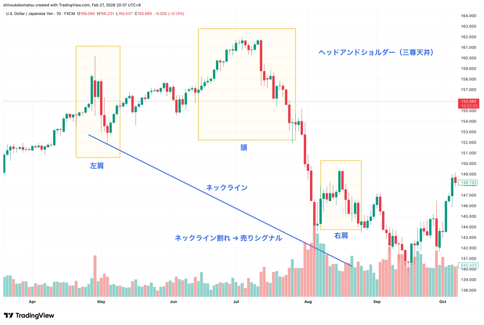 ダイヤモンドトップとヘッド&ショルダーズの構造的類似性